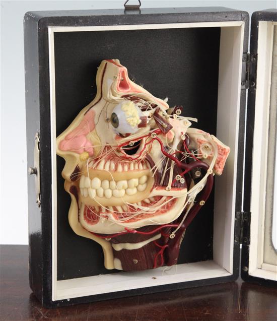 A Mittelwerk wax medical model of the internal workings of a human head, 9.5in.